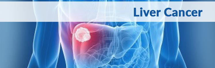 Liver Cancer Causes Factors | Symptoms